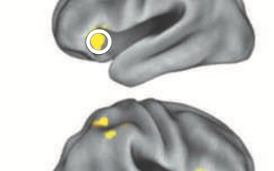 Distracción-Atención